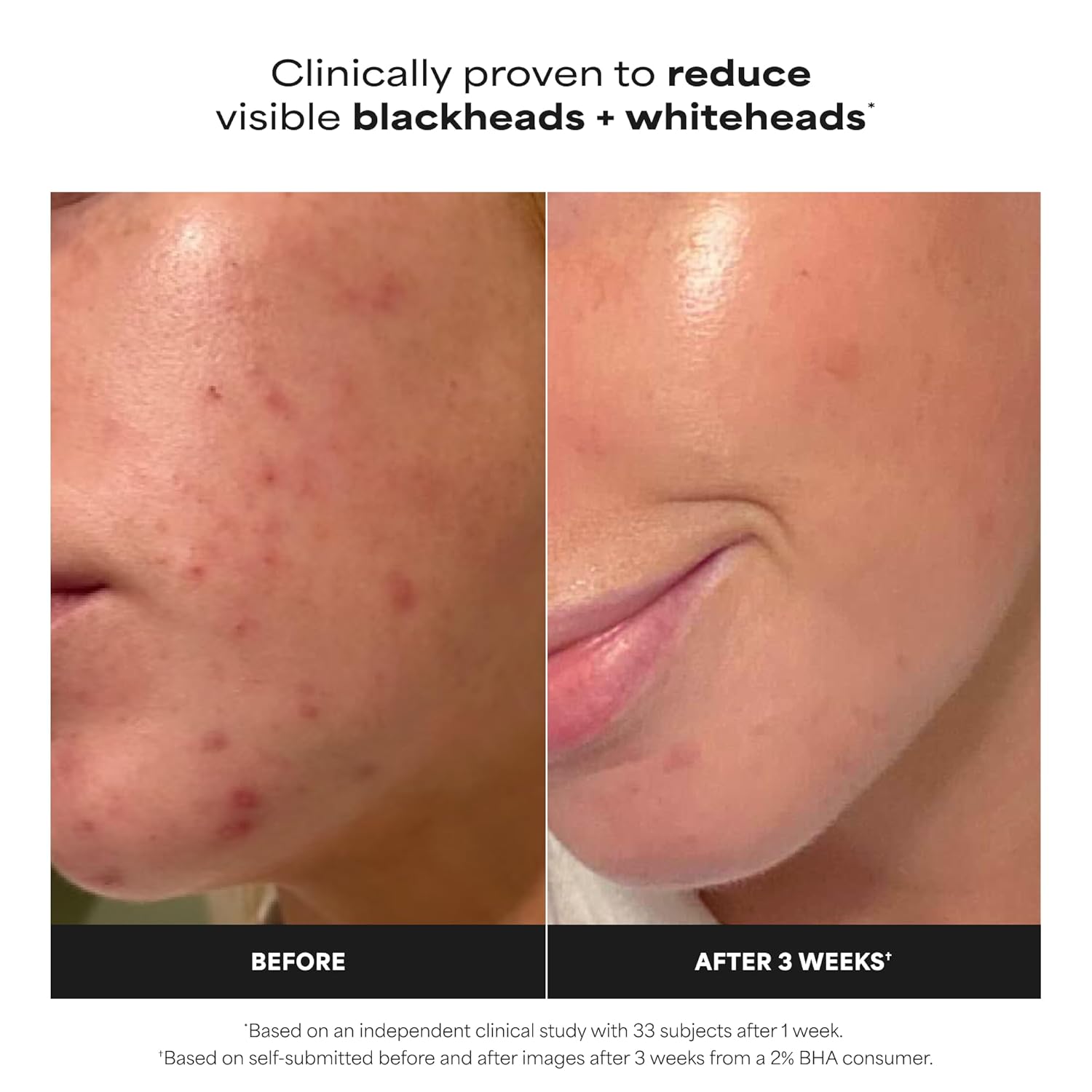 Radiant Glow Liquid Exfoliant