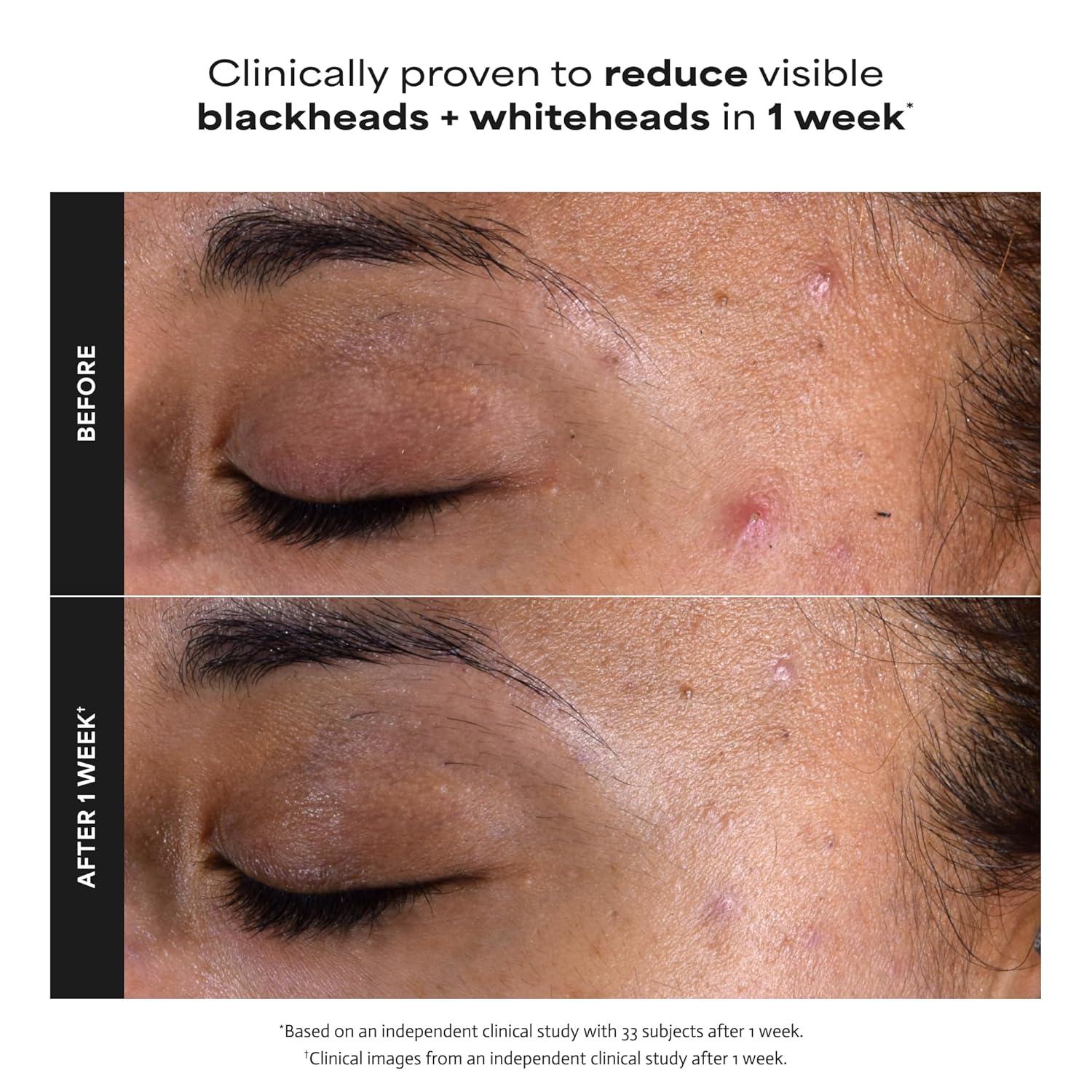 Radiant Glow Liquid Exfoliant